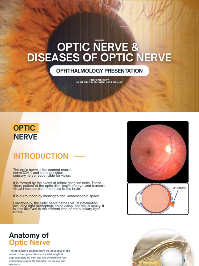 Optic Nerve and Its Diseases | PDF | Visual System | Retina