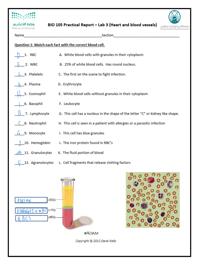 Lab Report (Heart and Blood Vessels) | PDF
