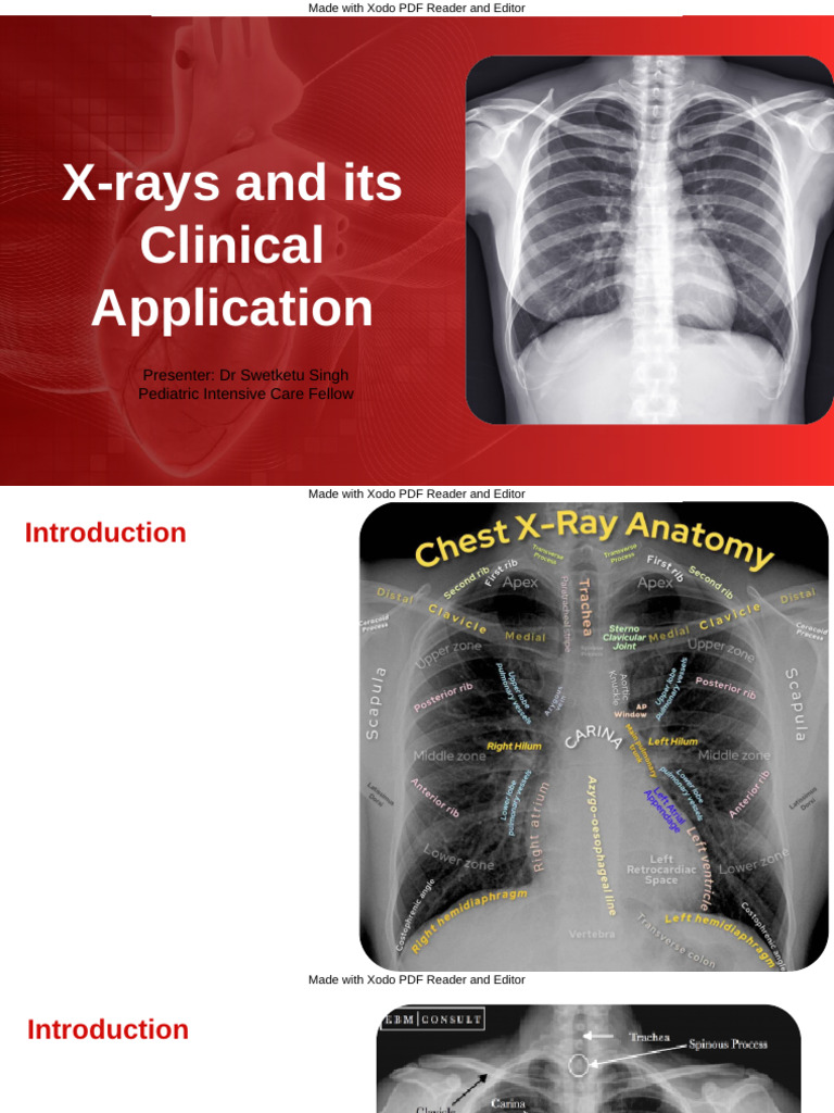 Xray | PDF | Heart | Thorax