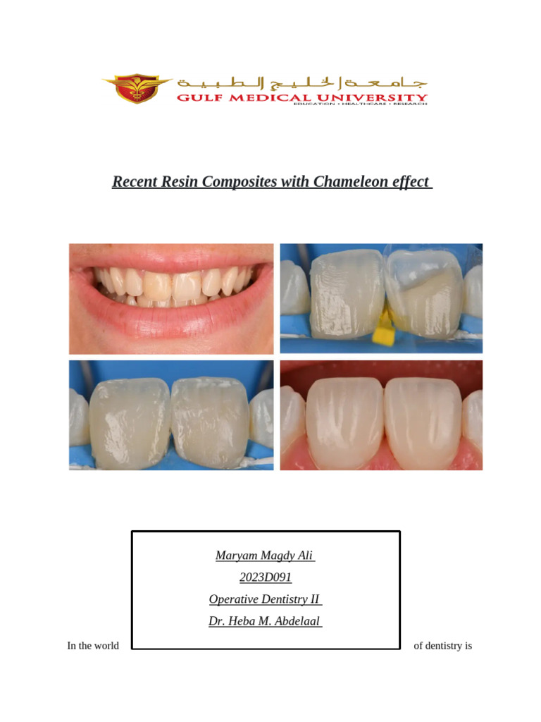 Recent Resin Composites With Chameleon Effect | PDF | Dental Composite ...