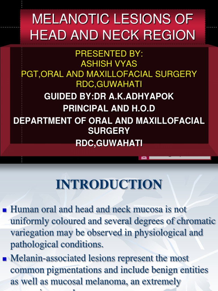 Melanotic Lesions in Head and Neck | PDF | Melanoma | Neck