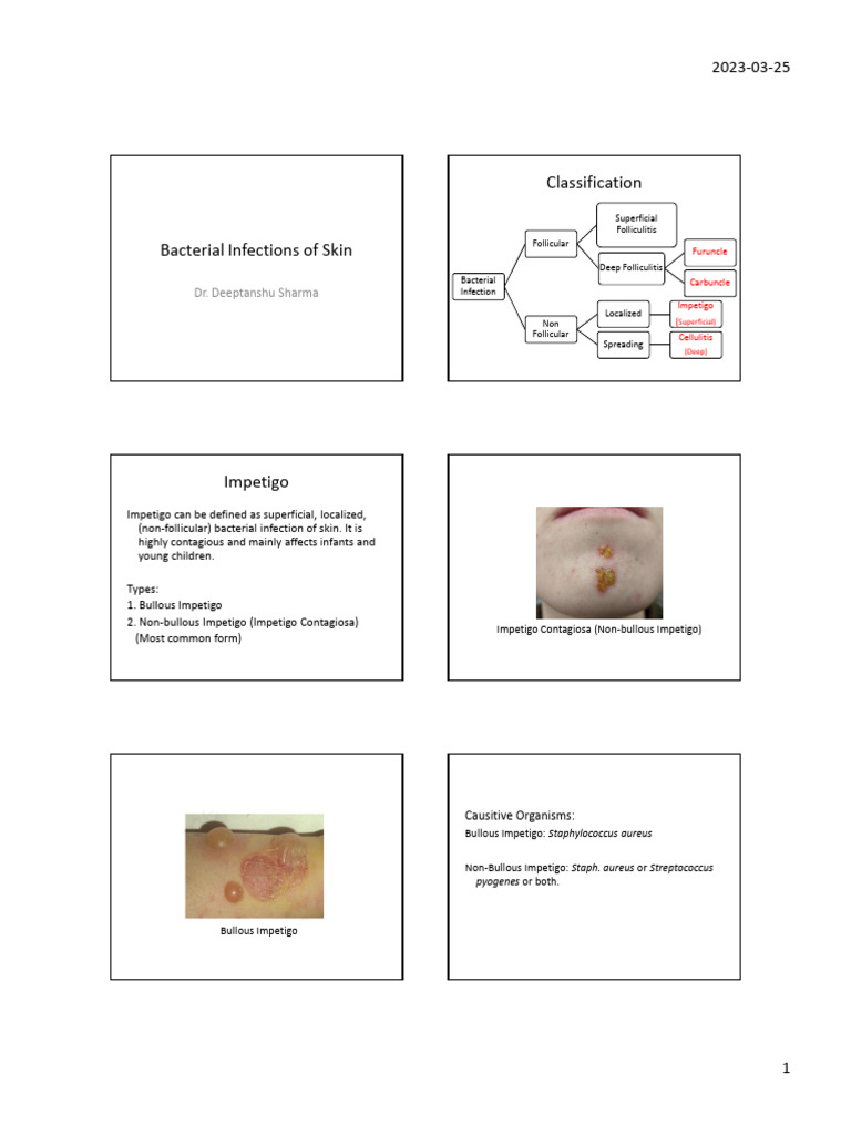 Bacterial Infections of Skin - 2b27c122 f3b6 47a6 Bbde 7f9a7f386b00 ...