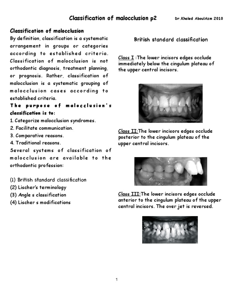 Classification of Mal | PDF | Facial Features | Tooth