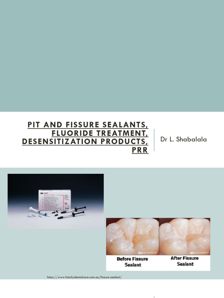 Fissure Sealants, PRR, Fluoride | PDF | Human Tooth | Tooth Enamel