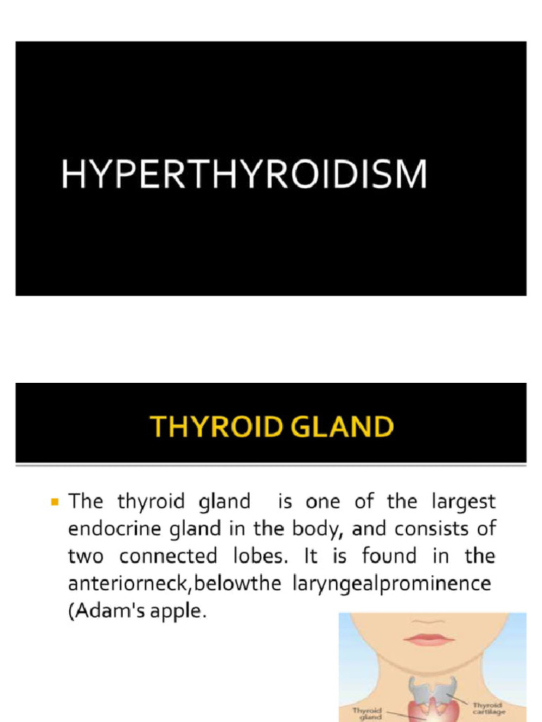 Hyperthyroidism PDF | PDF
