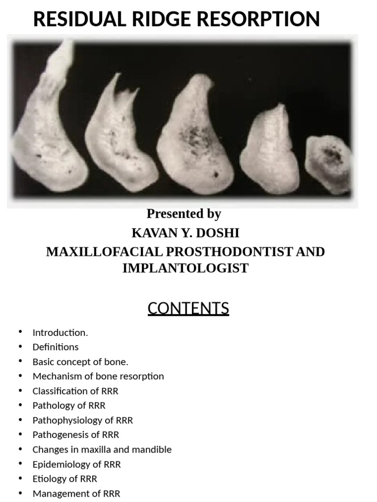 Residual Ridge Resorption by DR Kavan Doshi | PDF | Bone | Dental Implant