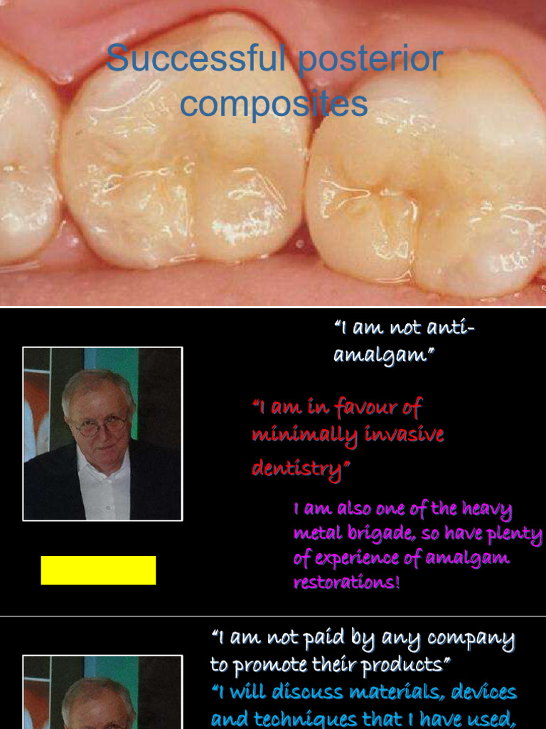 Posterior Comp Lecture Notes 0122 | PDF | Dental Composite | Human Tooth