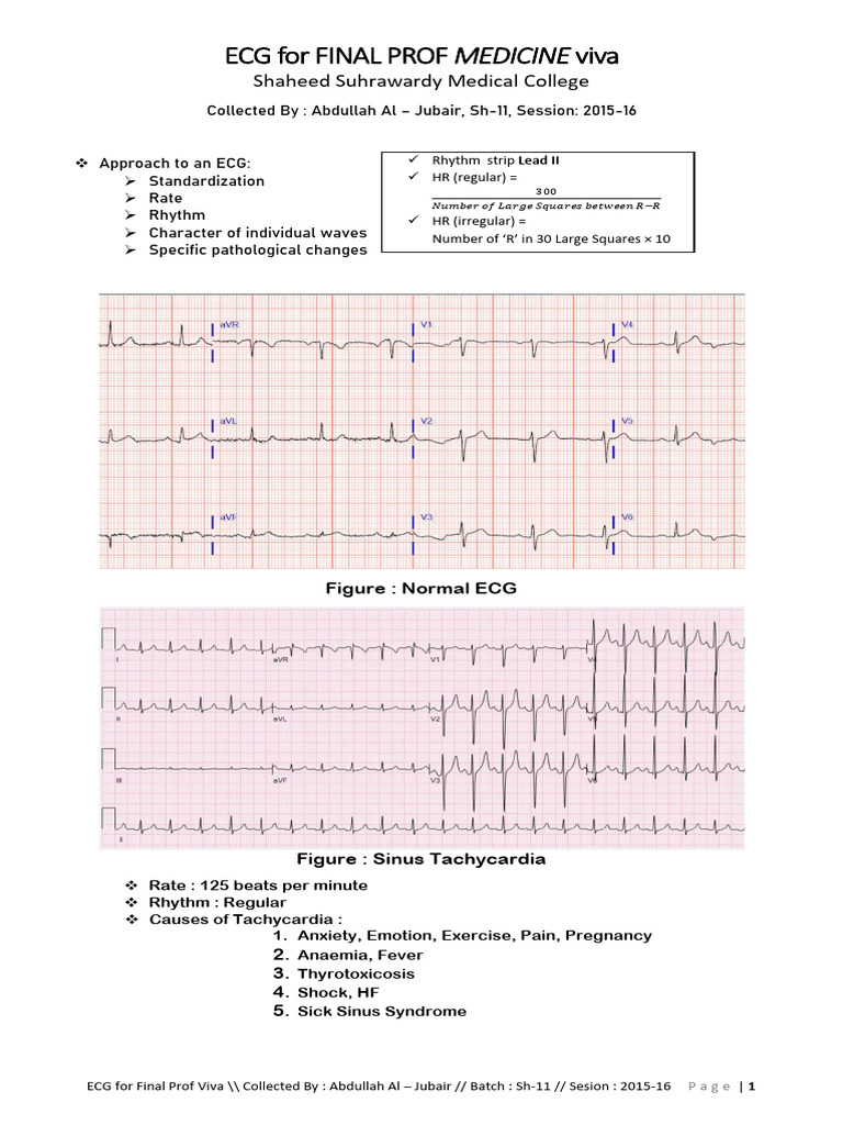 ECG For Final Prof 2022 | PDF