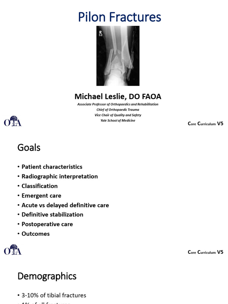 LE F&A1 Pilon Fractures | PDF