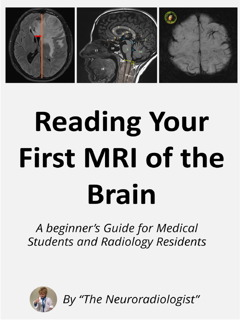 How To Read Your First Brain MRI | PDF | Medical Specialties | Nervous ...