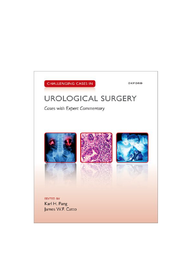 Challenging Cases in Urological Surgery Karl Pang Available Instanly | PDF