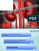 Glomerulonefritis Final