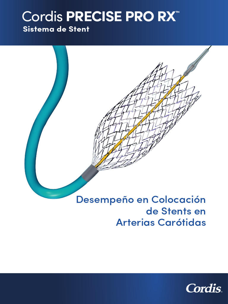 Cordis Precise Pro RX: Desempeño en Colocación de Stents en Arterias ...