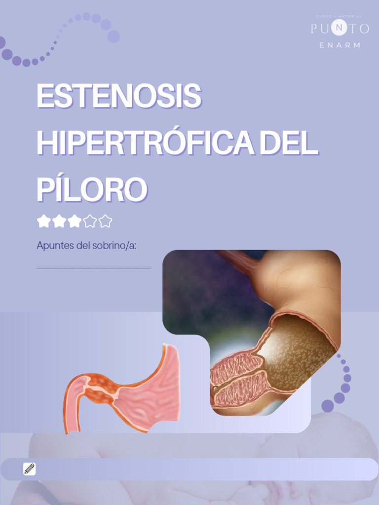 Estenosis Pilorica | PDF