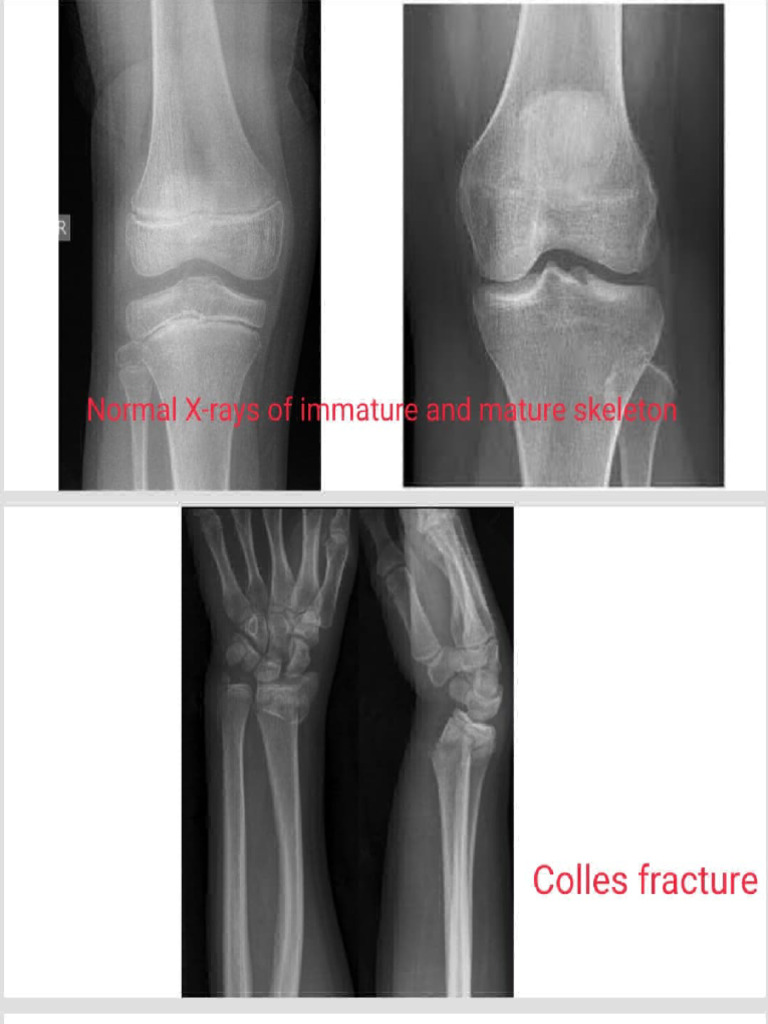 X Rays | PDF