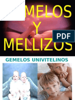 gemelos1-101009224016-phpapp02