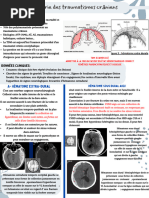 Hygrome sous-dural : causes et traitements | PDF | Liquide cérébro ...
