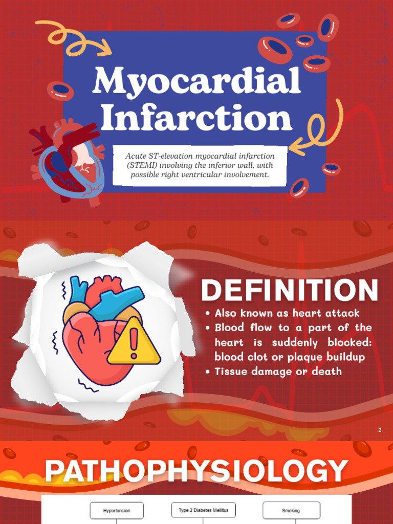 Group 4 - Myocardial Infarction | PDF | Myocardial Infarction ...