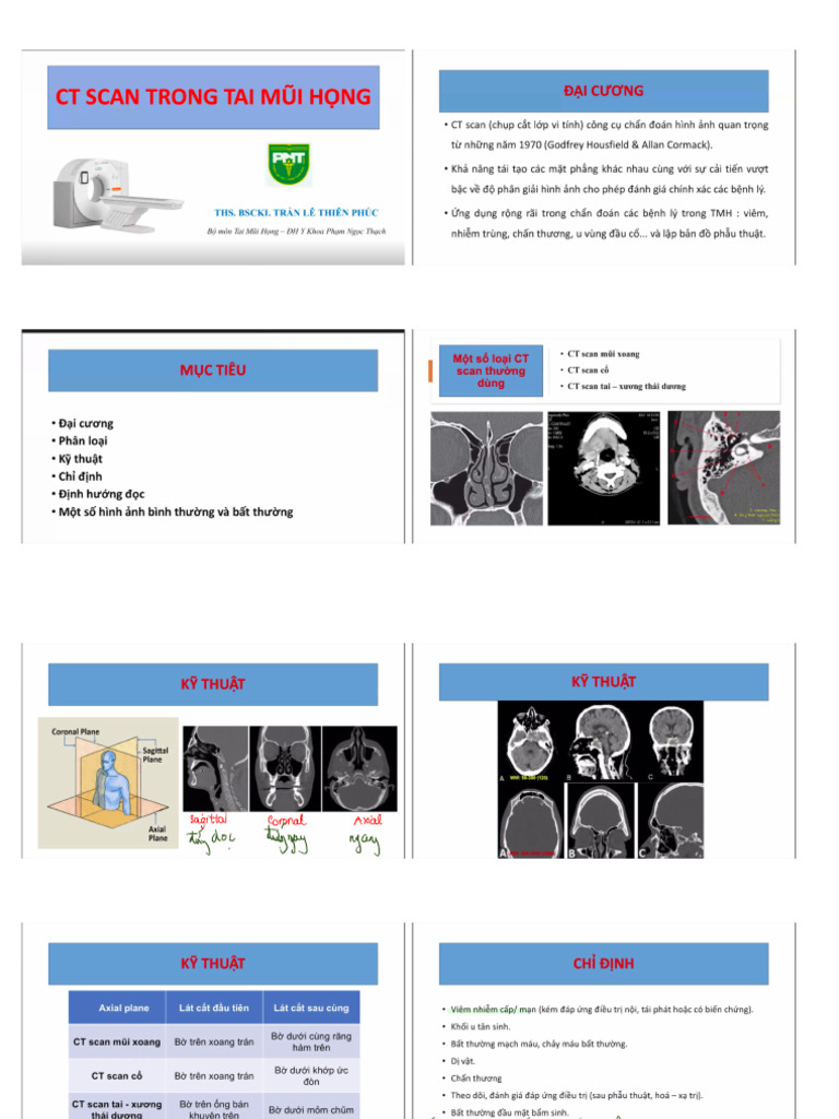CT-scan TMH | PDF
