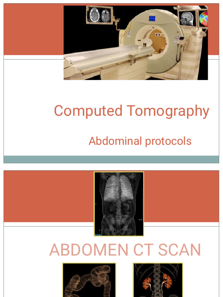 CT Protocols Abdomen 2 | PDF | Ct Scan | Abdomen