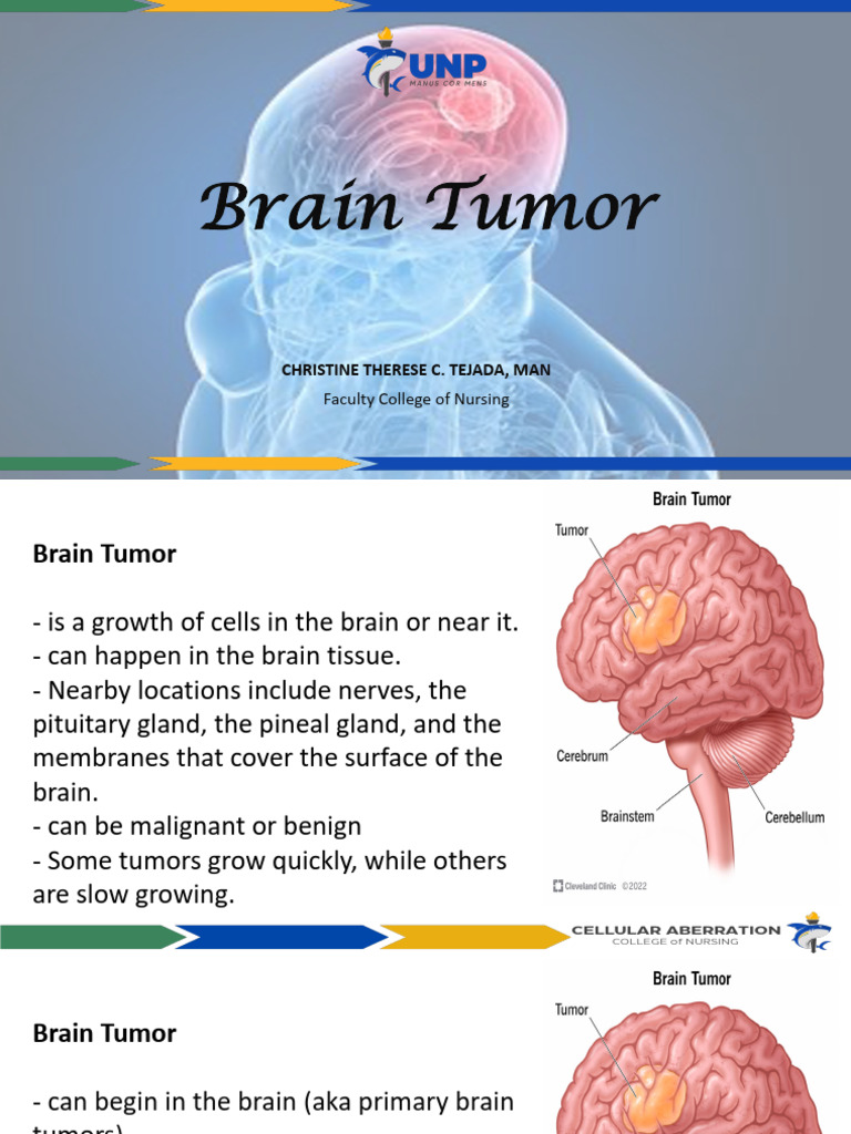 Brain Tumor | PDF | Brain Tumor | Benign Tumor