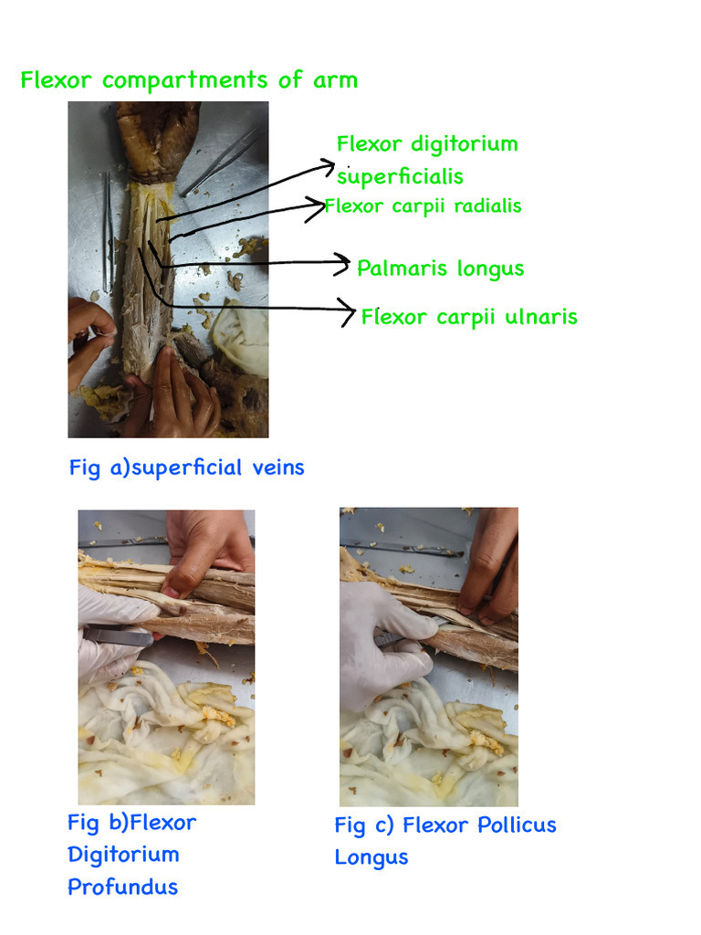 Flexor and Extensor Compartments of Forearm | PDF
