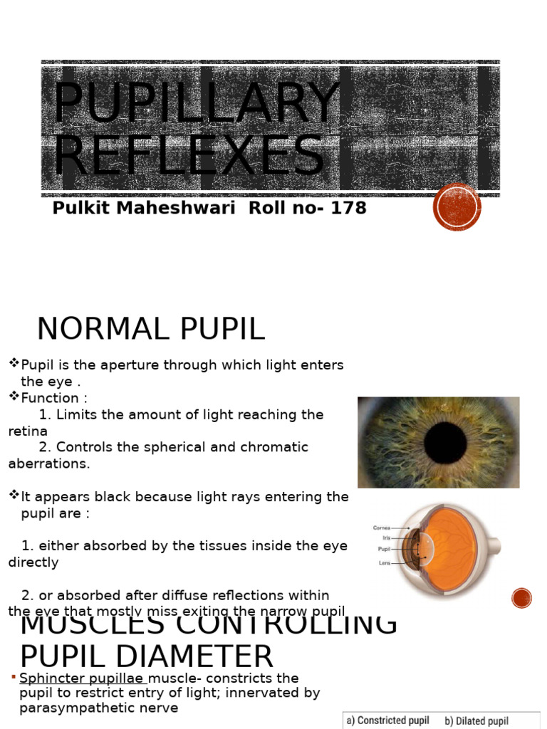 Pupillary Reflexes and lesions in ophthalmology | PDF | Ophthalmology ...