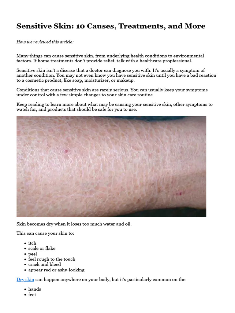 Sensitive Skin 10 Causes, Treatments, And More | PDF | Dermatitis ...