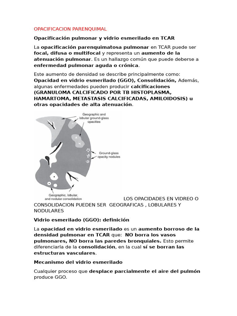 OPACIDAD PULMONAR | PDF | Neumonía | Pulmón