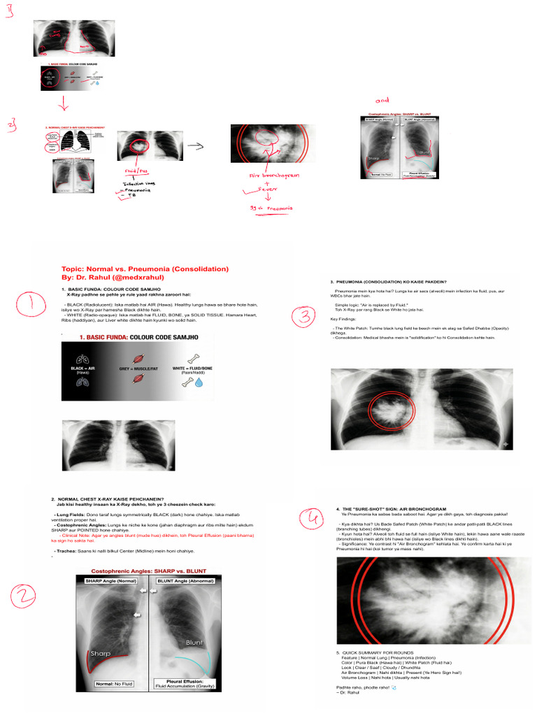 Chest X-Ray | PDF