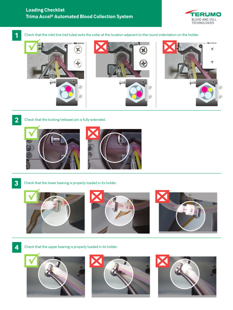 Trima Accel Loading Checklist | PDF