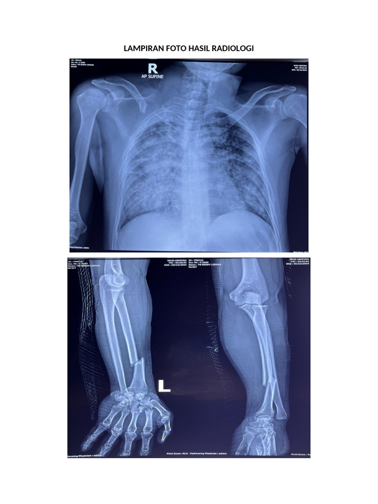 Lampiran Foto Hasil Radiologi | PDF