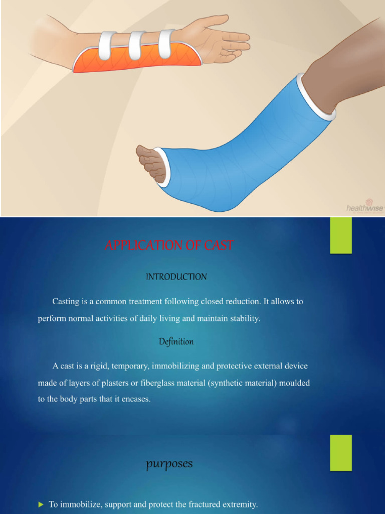 Care of Patient With Cast and Splint | PDF