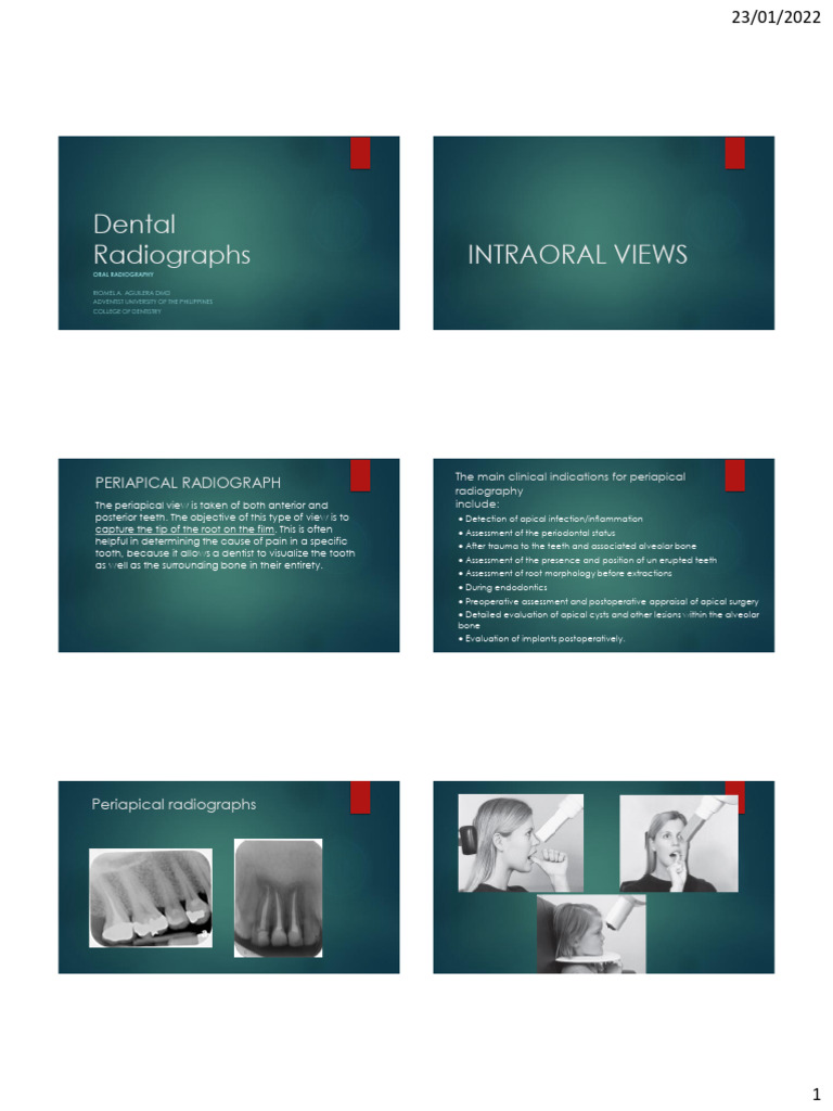 3. Different types of Radiographs used in Dentistry | PDF | Dentistry ...
