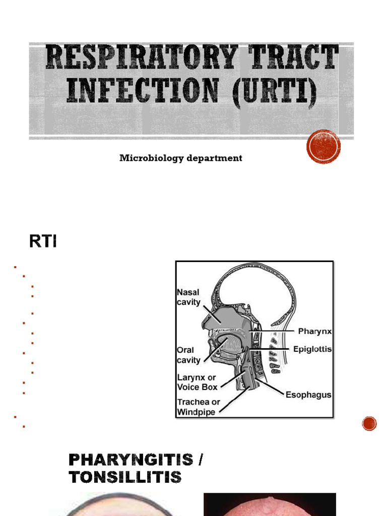 Upper respiratory tract infections | PDF | Immunology | Clinical Medicine