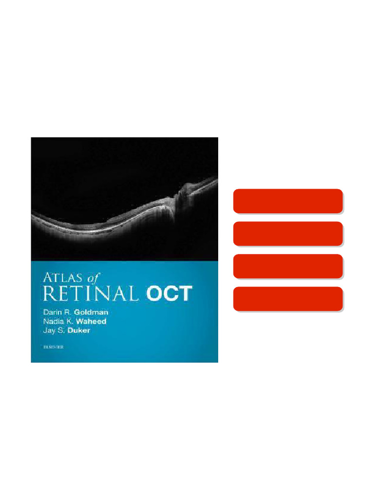 Atlas of Retinal OCT: Optical Coherence Tomography 1st Edition Darin ...