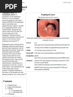 Esophageal Cancer - Wikipedia, The Free Encyclopedia