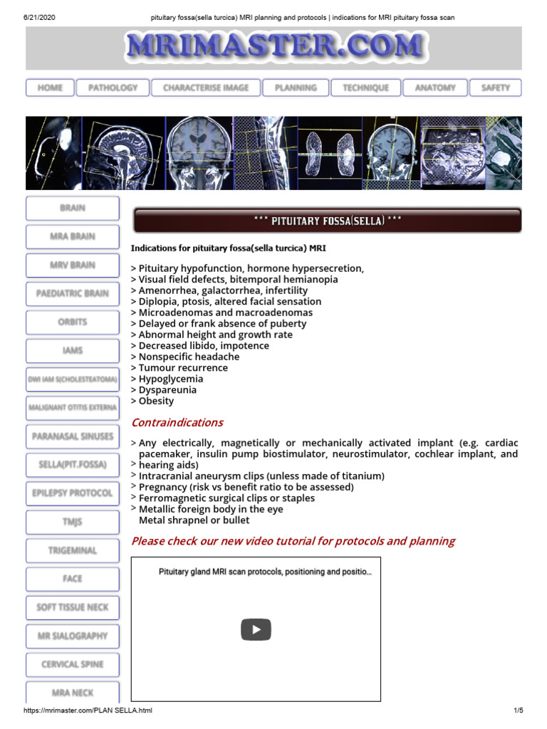 Pituitary Fossa(Sella Turcica) MRI Planning and Protocols _ Indications ...