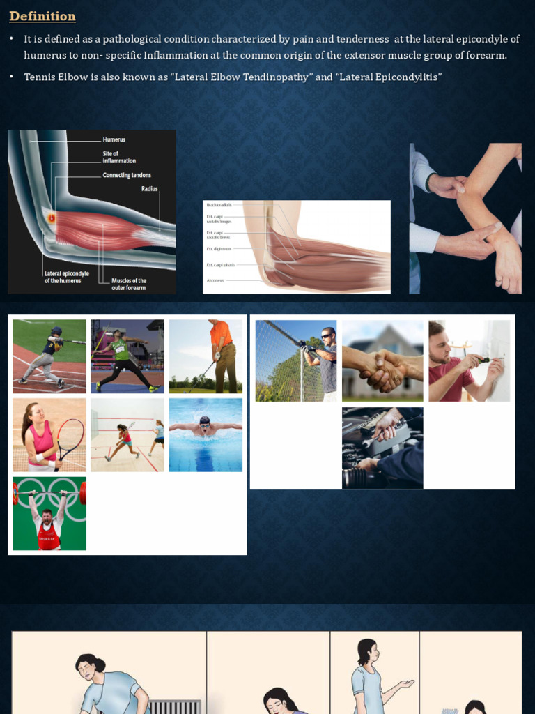 Tennis Elbow Presentation | PDF | Elbow | Anatomical Terms Of Motion