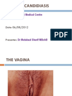 Vaginal Candidiasis
