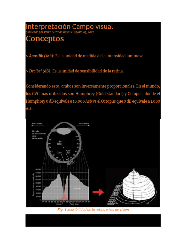 Interpretación Campo Visual | PDF | Glaucoma | Sensibilidad y especificidad