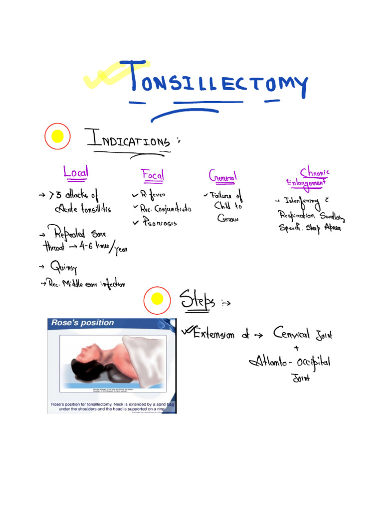 Tonsillectomy | PDF