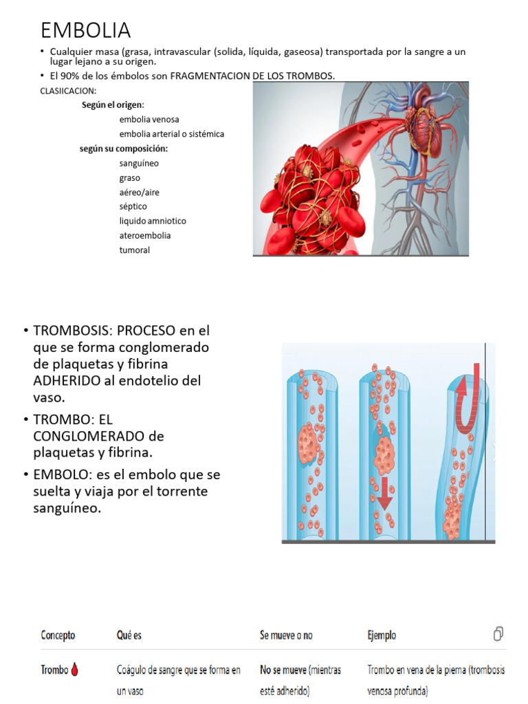 embolia | PDF