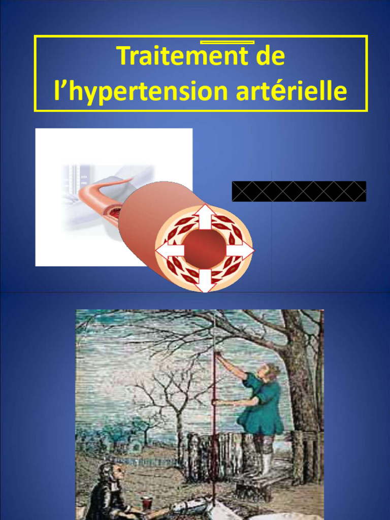 HTA, thérapeutique | PDF | Hypertension artérielle | Néphrologie