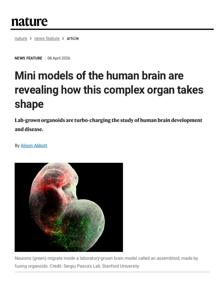 Mini Models of the Human Brain Are Revealing How This Complex Organ ...