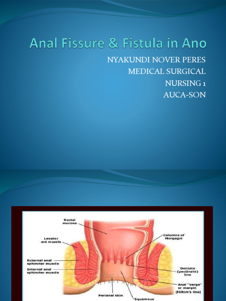 Anal Fistula | PDF | Vein | Rectum