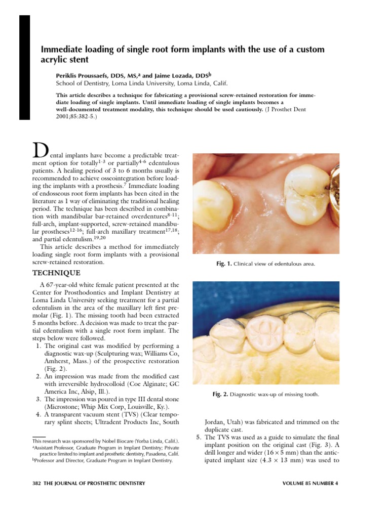 A Simple Method of Fabricating An Interim Obturator Prosthesis by