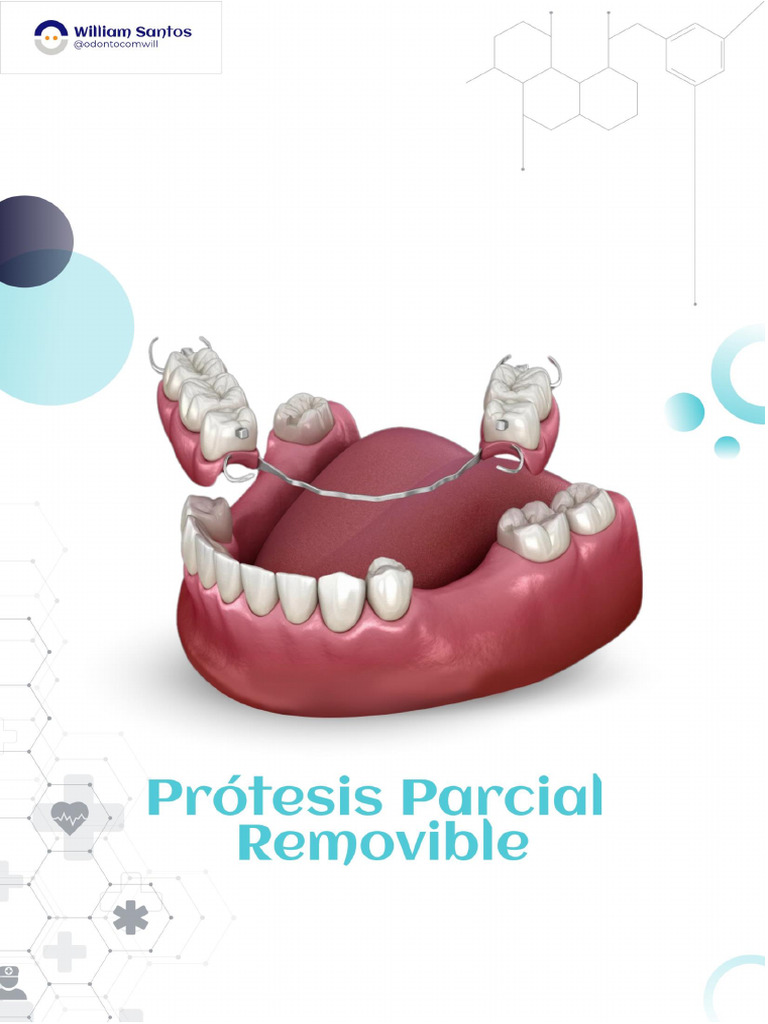 Prótesis Parcial Removible | PDF | Yeso | Odontología