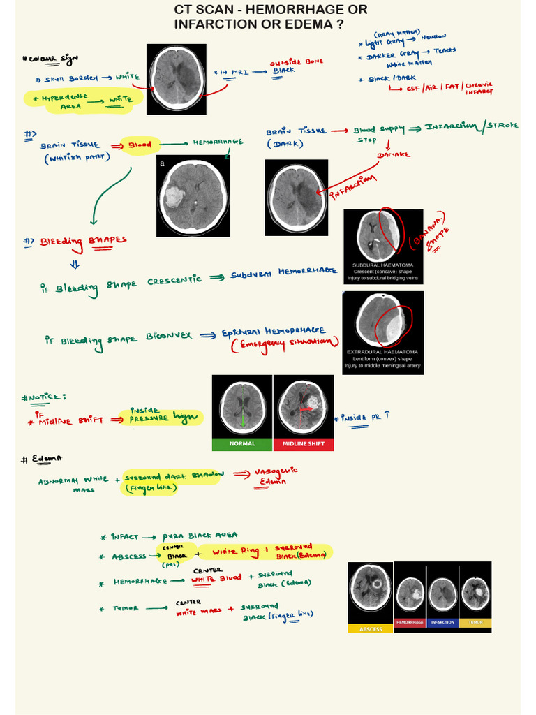 CT SCAN-1 | PDF