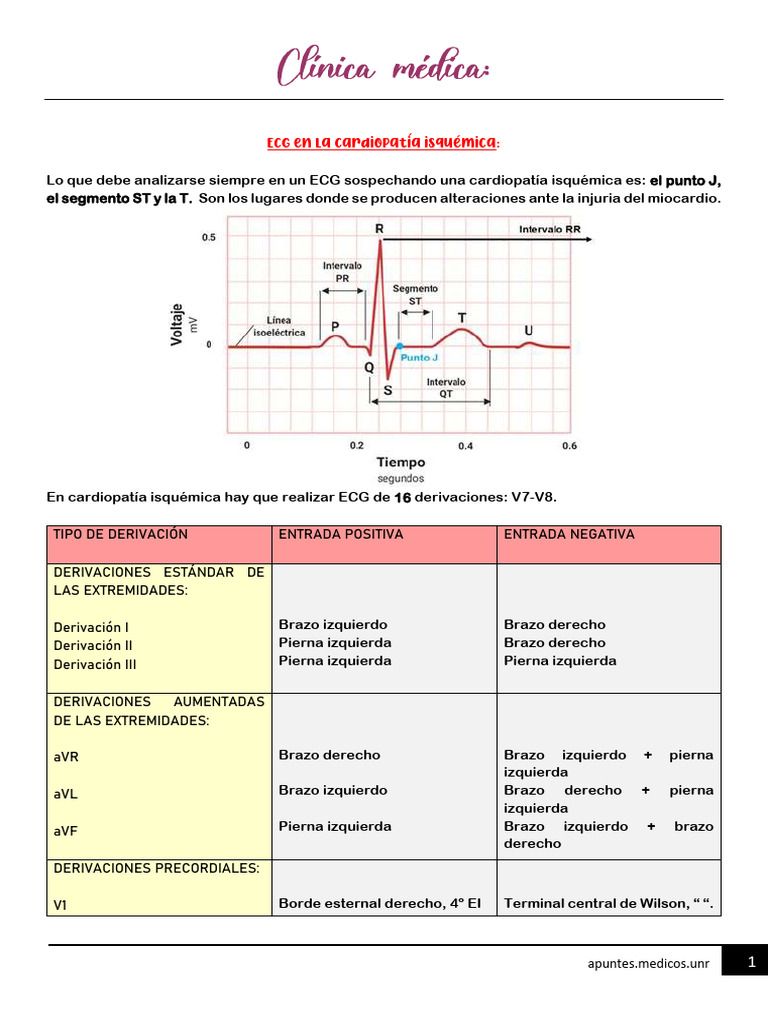 Seminario ECG en La Cardiopatía Isquémica | PDF | Infarto de miocardio ...